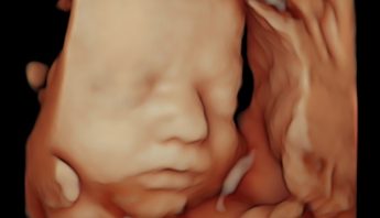 4D BABY SCAN PREMIUM PACK