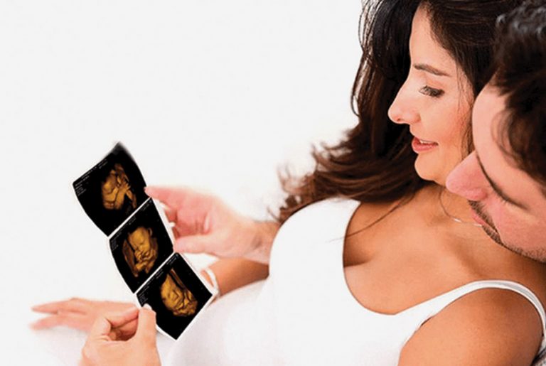 4D Baby Scan Premium Package by Private Ultrasound Scans London