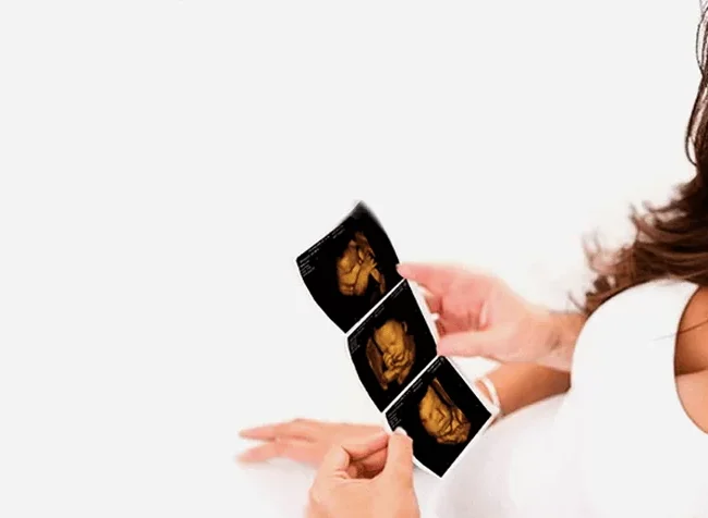 Bonding with your baby at Private Ultrasound Scans London