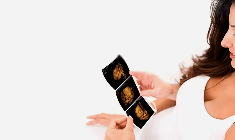 Bonding with your baby at Private Ultrasound Scans London