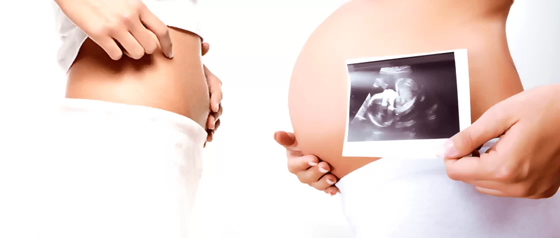 The journey of pregnancy by Private Ultrasound Scans London