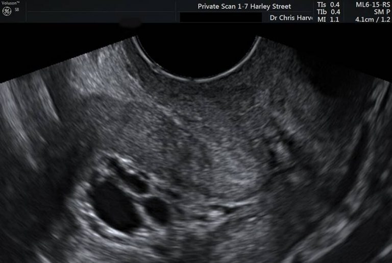  Private Ultrasound Scans London