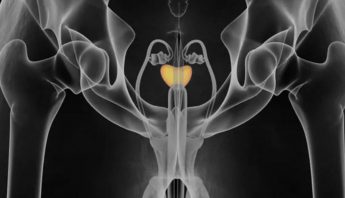 PROSTATE TRANSRECTAL SCAN