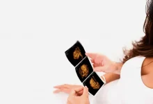 Bonding with your baby at Private Ultrasound Scans London